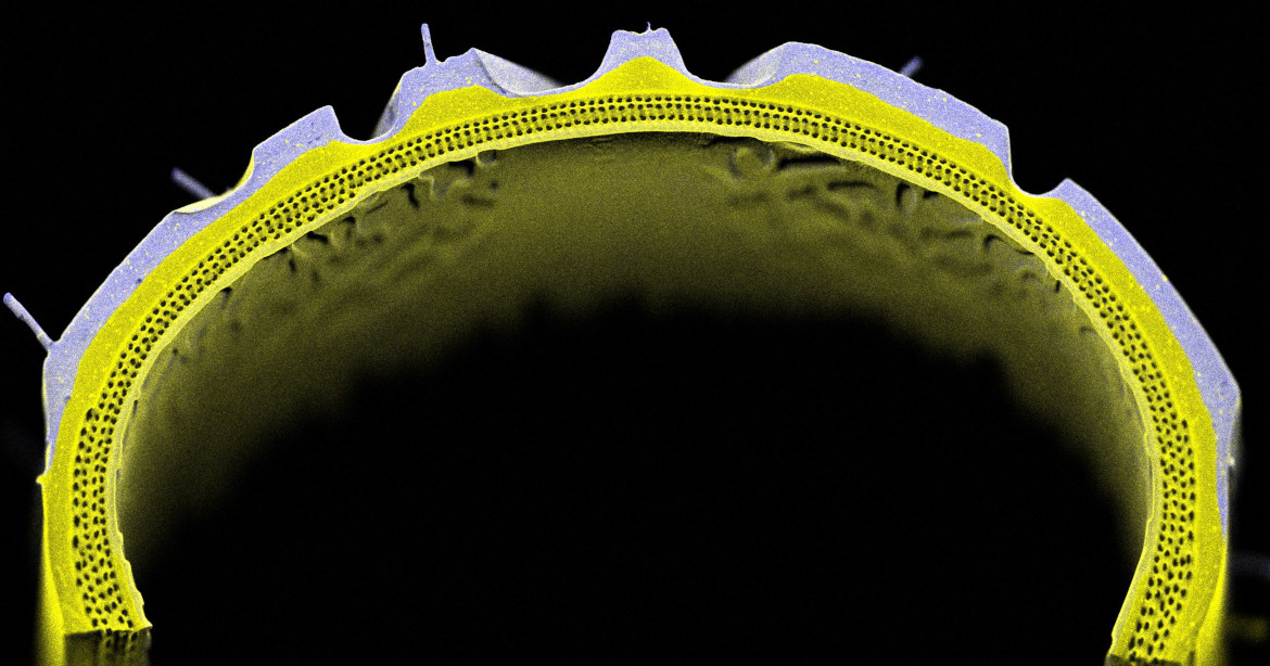 Micro-X-ray fluorescence image of a tire.