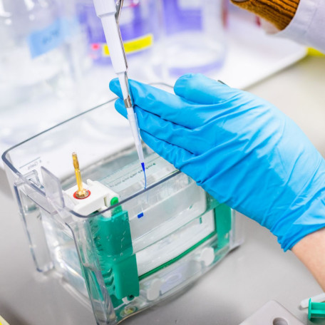 A hand holding a pipette. A polyacrylamide gel electrophoresis (PAGE) is prepared to analyze regulatory RNAs...