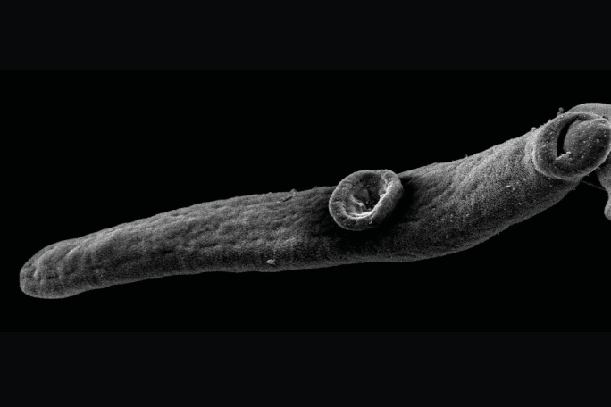 Parasitic worm, picture made by a scanning electron microscope