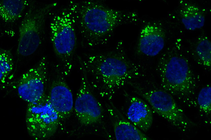 Fluorescence microscopy images of of supramolecular cages with small green dots and thick blue dots.
