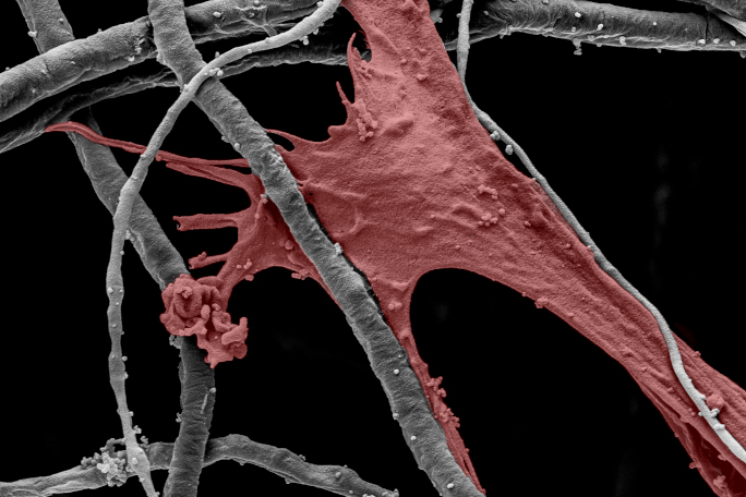 Cell interacting with biomaterial fiber